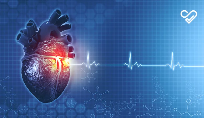 Coronary Artery Disease