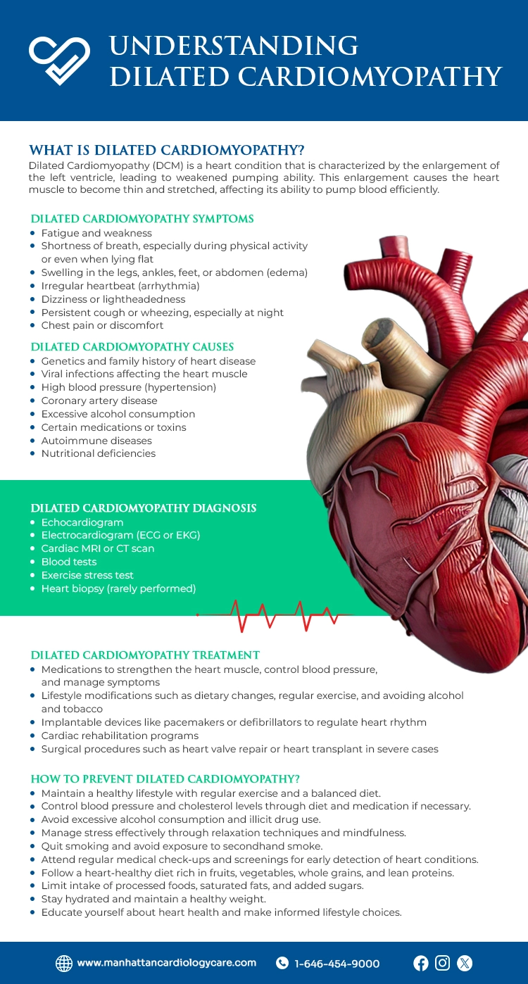 dilated cardiomyopathy