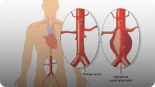 heart condition image