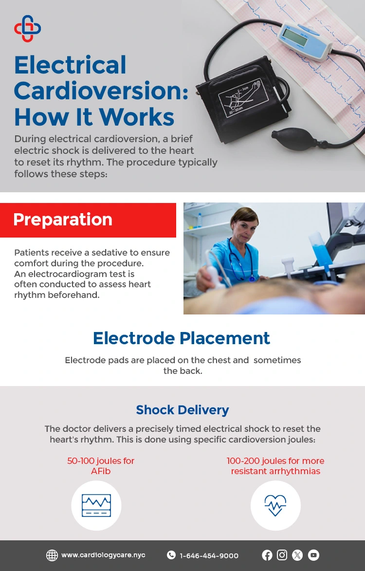 Electrical Cardioversion: How It Works