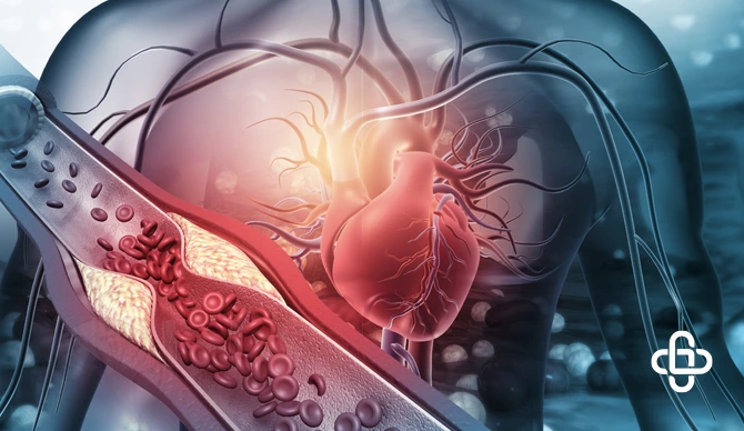 Exploring Ischemic vs Non-Ischemic Heart Disease