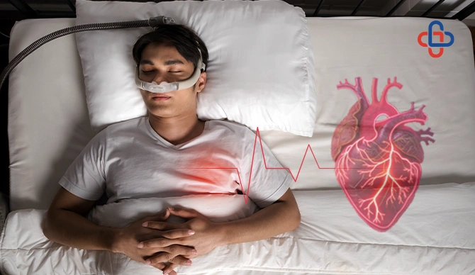 How Does Sleep Apnea Affect The Heart