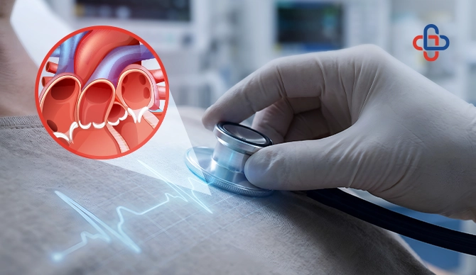 What Causes Mitral Valve Regurgitation & How Is It Treated?