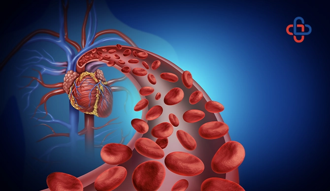Poor Blood Circulation What Causes It And How To Improve It